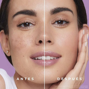 CREMA ACLARANTE CORPORAL | ACLARA, HIDRATA Y RENUEVA💫