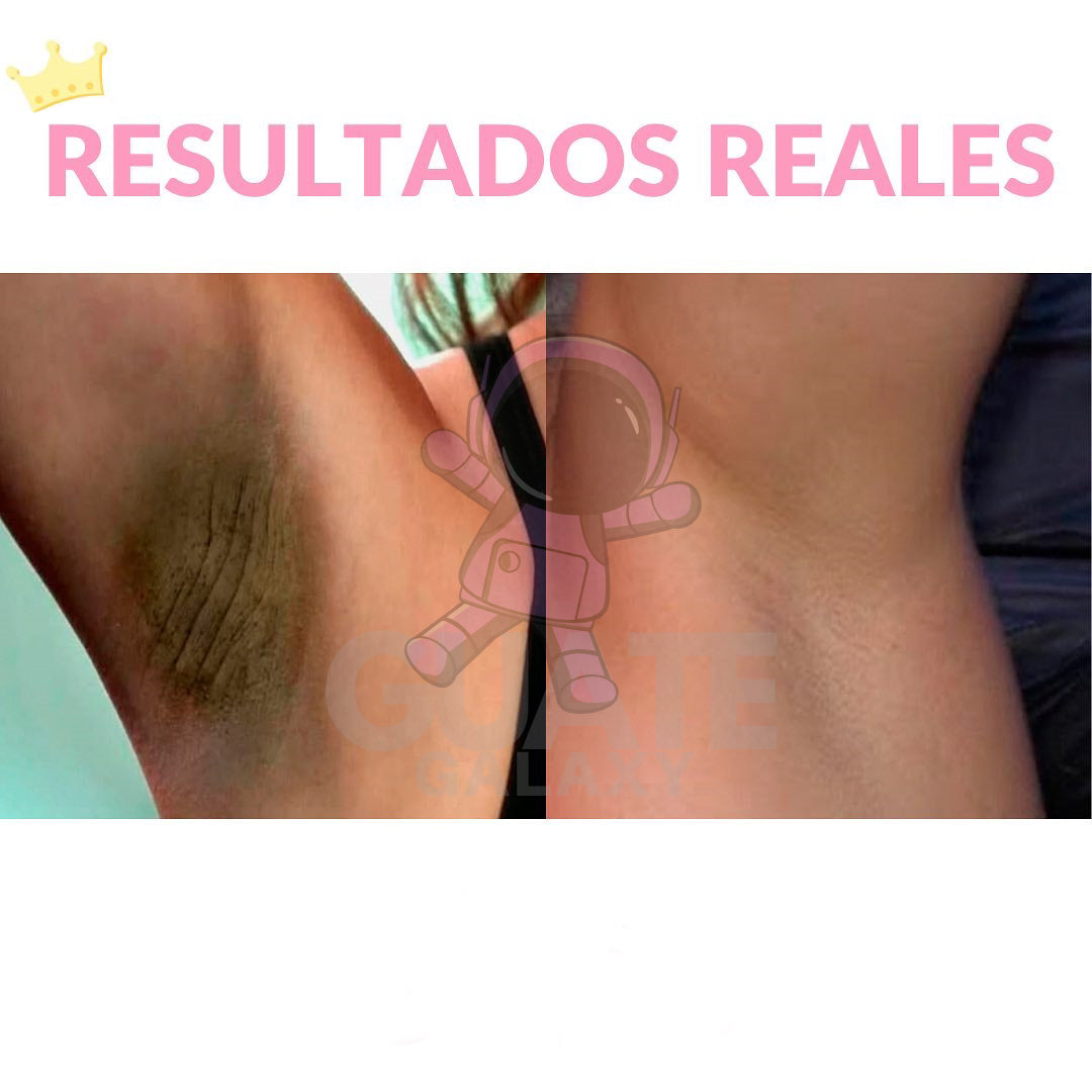 CREMA ACLARANTE CORPORAL | ACLARA, HIDRATA Y RENUEVA💫