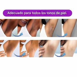 CREMA ACLARANTE CORPORAL | ACLARA, HIDRATA Y RENUEVA💫